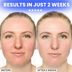 Masque LED 7 Couleurs - Rajeunissez votre peau!